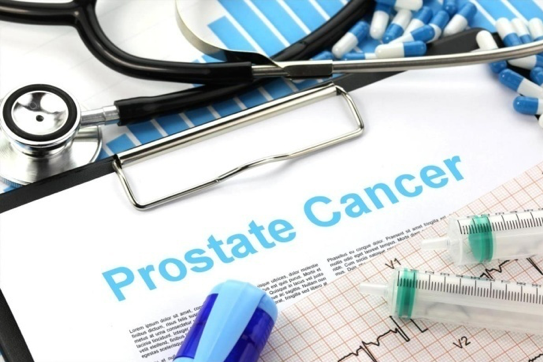 Enhanced Sex Life May Prevent Enlarged Prostate